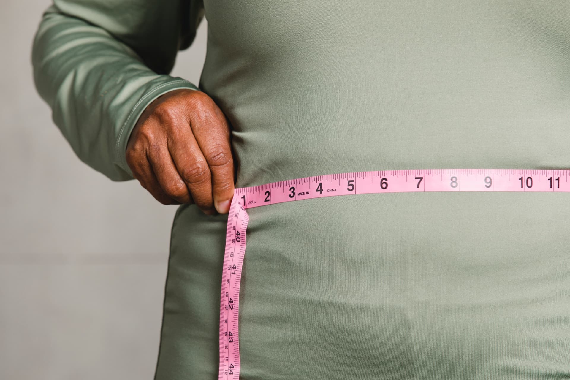Weight-loss surgery