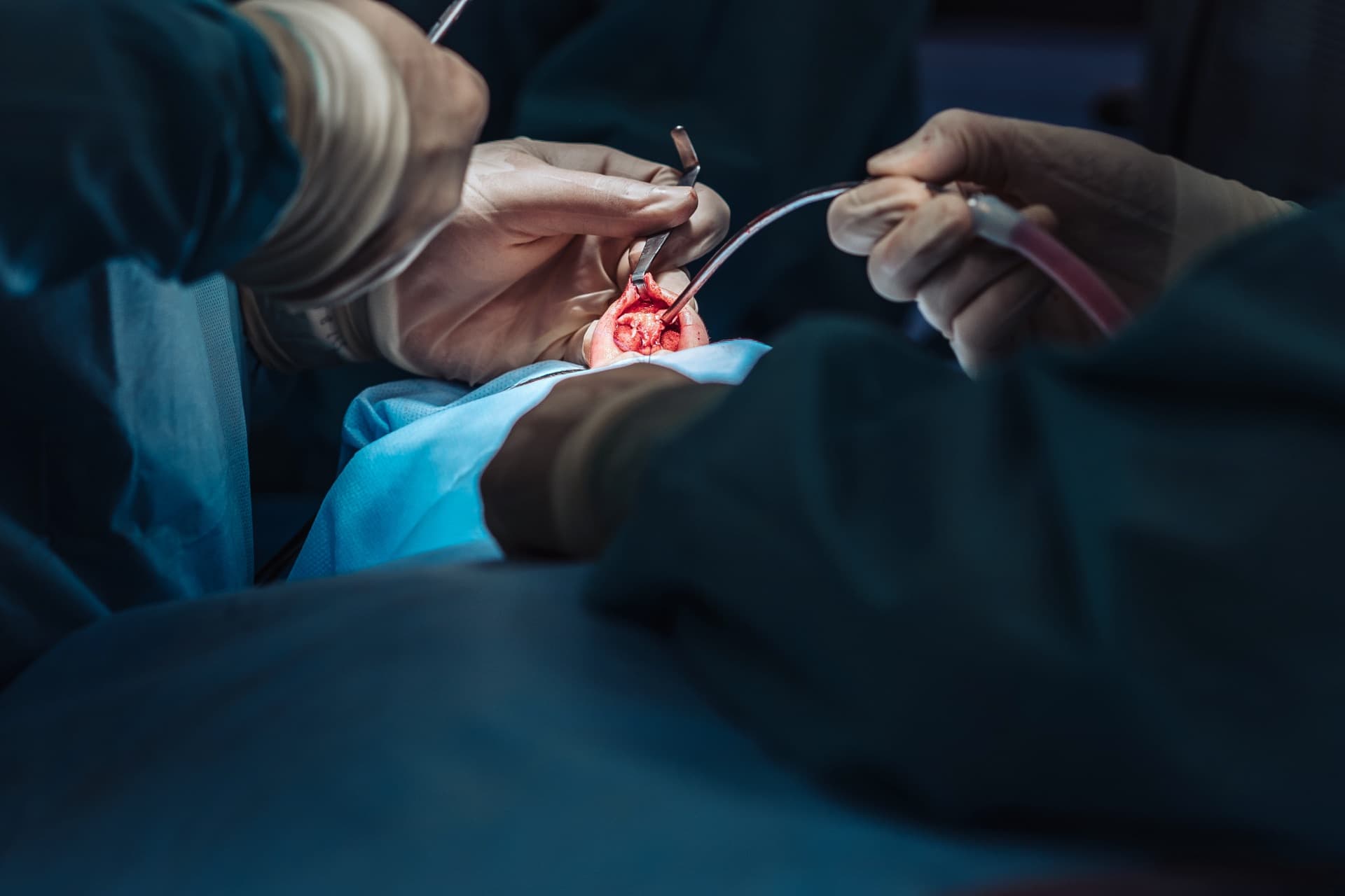 Getting surgery in Mexico